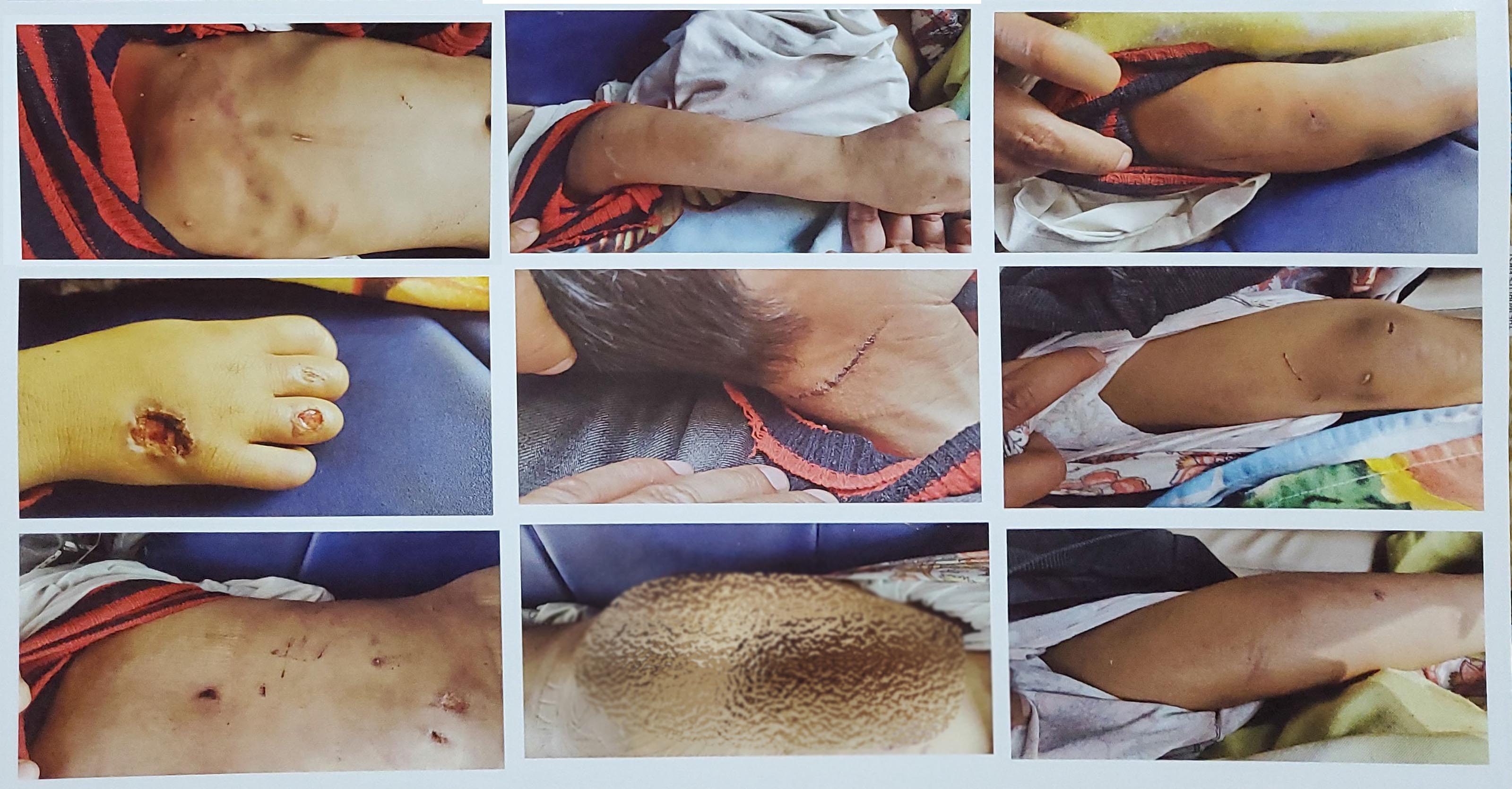 Eastern Sentinel Arunachal News